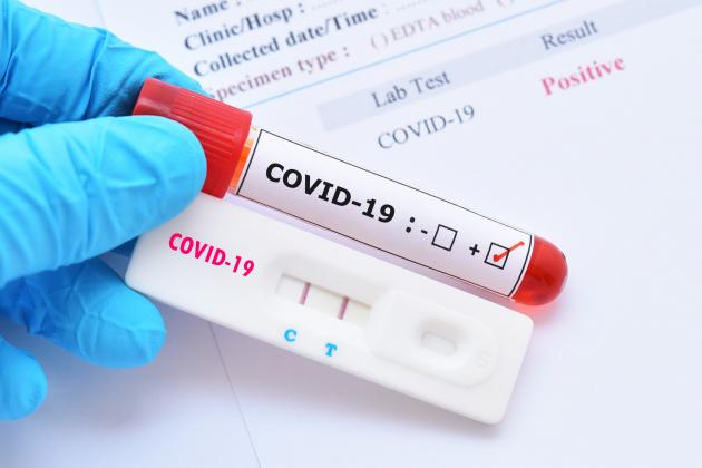 Cum-se-falsifica-testele-COVID-19-O-asistenta-a-fost-prinsa-in-fapt.-Mii-de-oameni-in-pericol