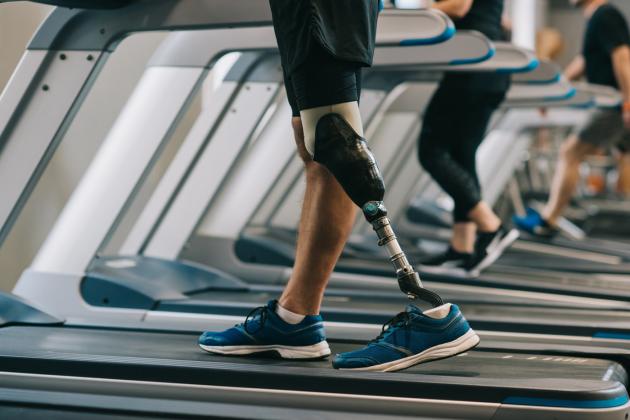 prosthetic-leg