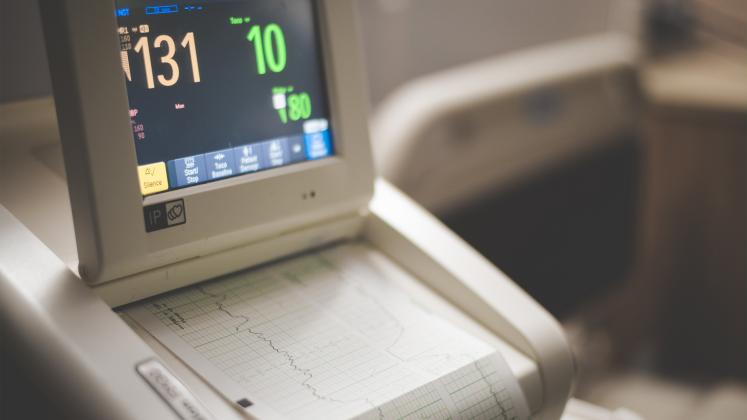 Aparat de ultrasonografie