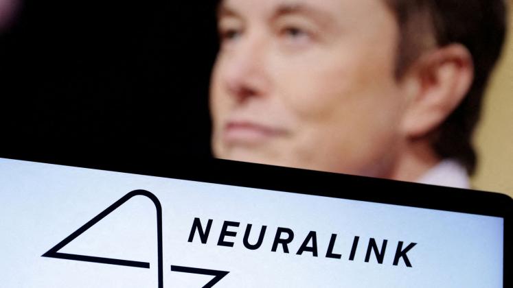 neuralink-implant-musk_6437623