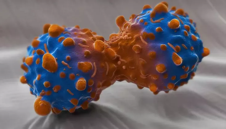 how-does-lung-cancer-start (1)