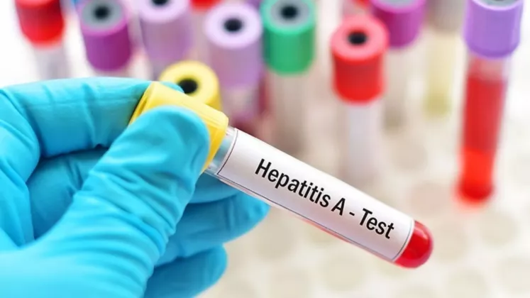 hepatita A