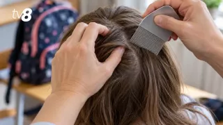 /VIDEO/ Păduchi și scabie în unele școli din Chișinău: Asistentele medicale nu reușesc să verifice toți elevii