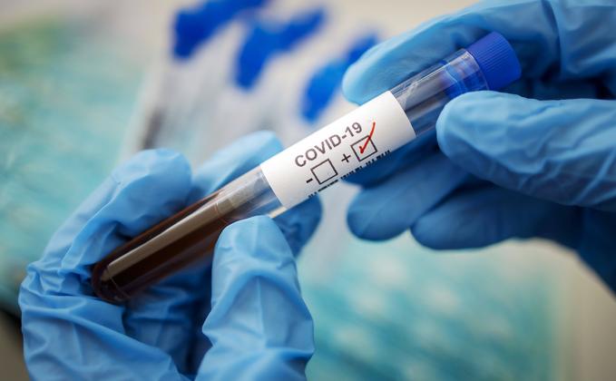 gestellte-aufnahme-symbolfoto-coronavirus-diagnose-covid-19-sars-cov-2-berlin-17-03-2020-berlin-deutschland-pr