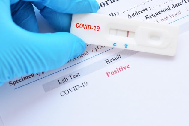positive-test-result-by-using-rapid-test-device-for-covid-19