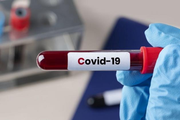 covid-19-blood-test
