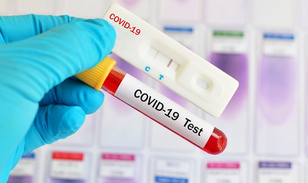 teste-exame-covid-coronavirus