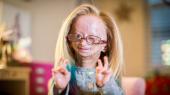 /FOTO/ Adalia Rose, fetița comparată cu personajul „Benjamin Button”,  care suferea de o boală genetică rară, a murit la 15 ani