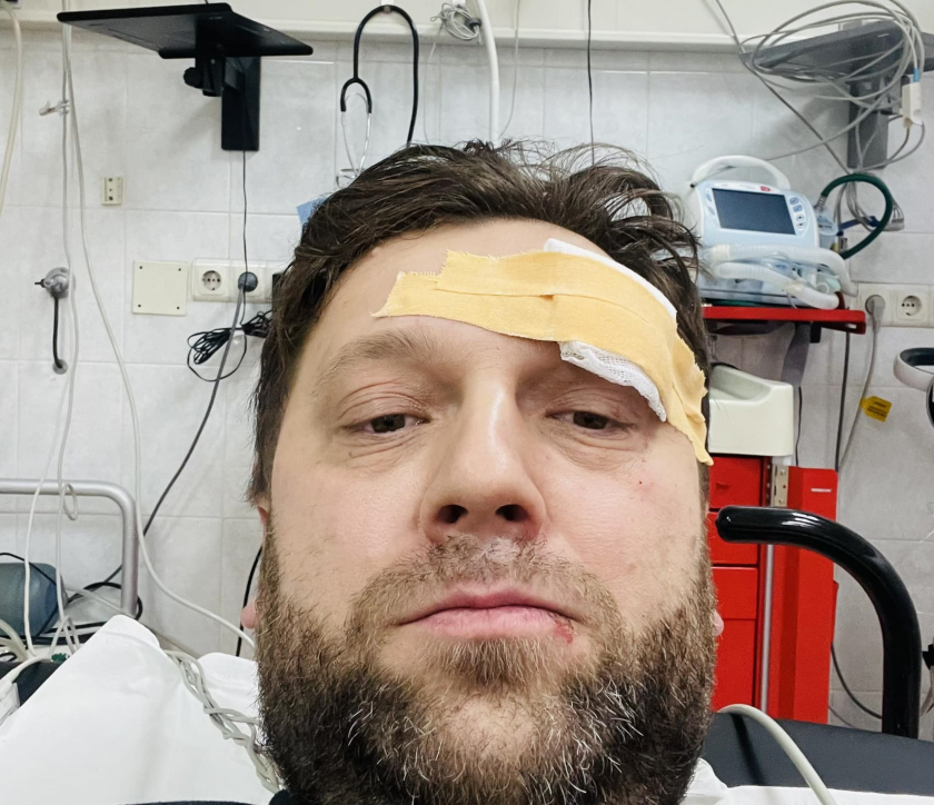 "Нелепый инцидент". Алайба опубликовал фото из больницы с повязкой на лбу