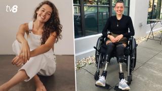 Povestea fotomodelului care și-a pierdut picioarele din cauza COVID-19 și a suferit o operație la inimă: „Am viața în față”