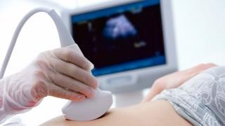 В частных клиниках Липецкой области РФ запретили делать аборты