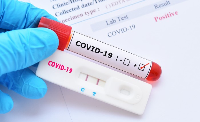 В Молдове снижается заболеваемость COVID-19: за неделю зарегистрировали 378 случаев