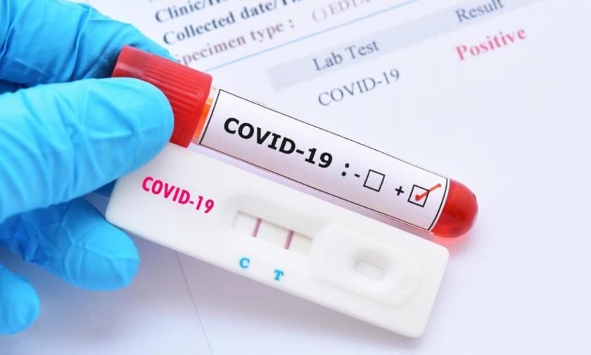 R. Moldova a ajuns la 3780 de decese și peste 176 de mii de infectări cu virusul Covid-19