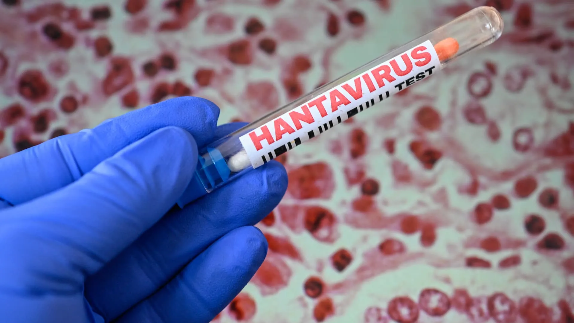 /VIDEO/ Alertă după focarul de hantavirus. Șeful OMS: „Ne așteptăm la mai multe cazuri în săptămânile următoare”
